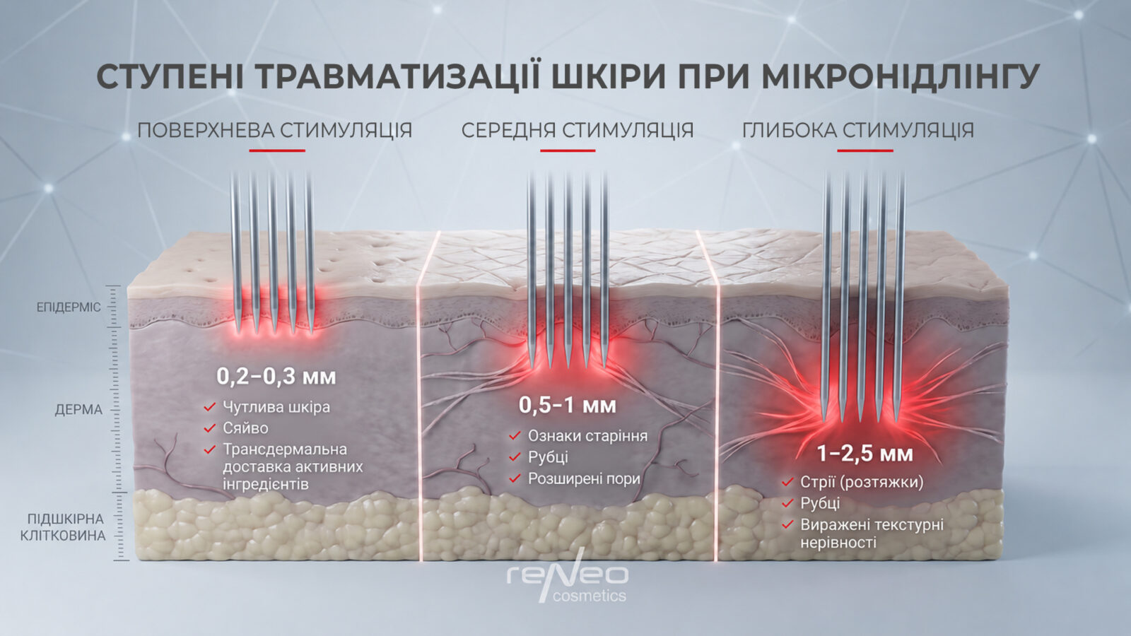 Ступені травматизації шкіри при мікронідлінгу: глибина голок від 0,2 до 2,5 мм у розрізі шкіри